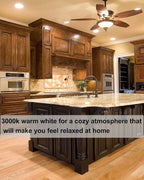 Vinaco PAR20 Halogen Light Bulbs, 6PCS 39W PAR20 Halogen Dimmable, 3000k Warm White, High Brightness PAR 20 Flood 39W 120V 480 Lumens Equivalent PAR 20 50W 120V, E26 Medium Base for Track Lights