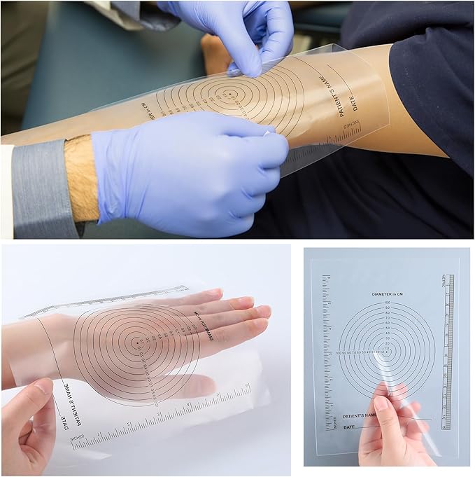 300 Pack Wound Measurement Tools Measuring Bullseye Guide Medical Wound Ruler Soft Flexible Measure Guide for Nurses Patient